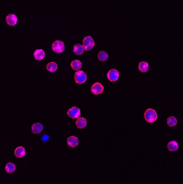 IF of MOLT-4 cells stained with DSHB antbody CPTC-GSK3B-5 against GSK3B (pink-violet), anti alpha-tubulin (red), and DAPI (blue). Image credit: Clinical Proteomics Technologies for Cancer.